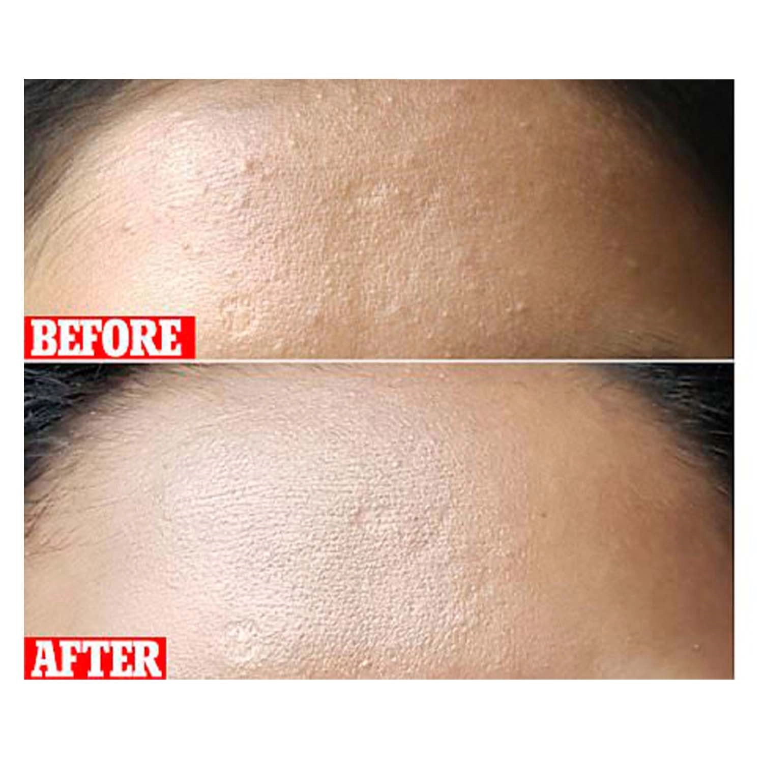 لایه بردار کوزارکس کره جنوبی