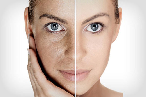 سرم پیلینگ و لایه بردار لورآل اصل